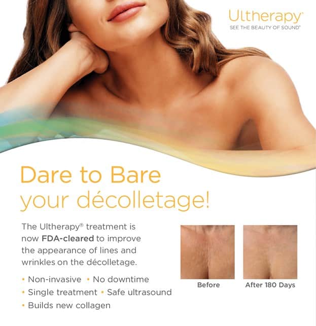 מתיחת אזור מחשוף/דקולטה