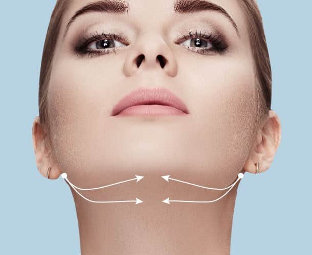 טיפול בסנטר כפול - חוטי אפטוס