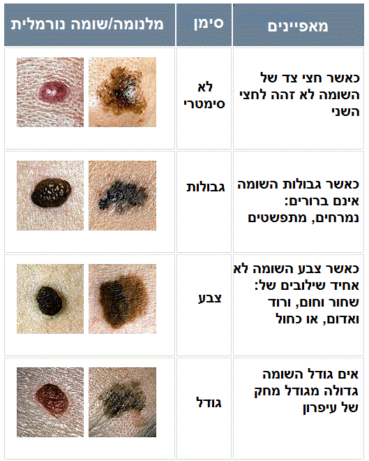 נקודות חן חשודות