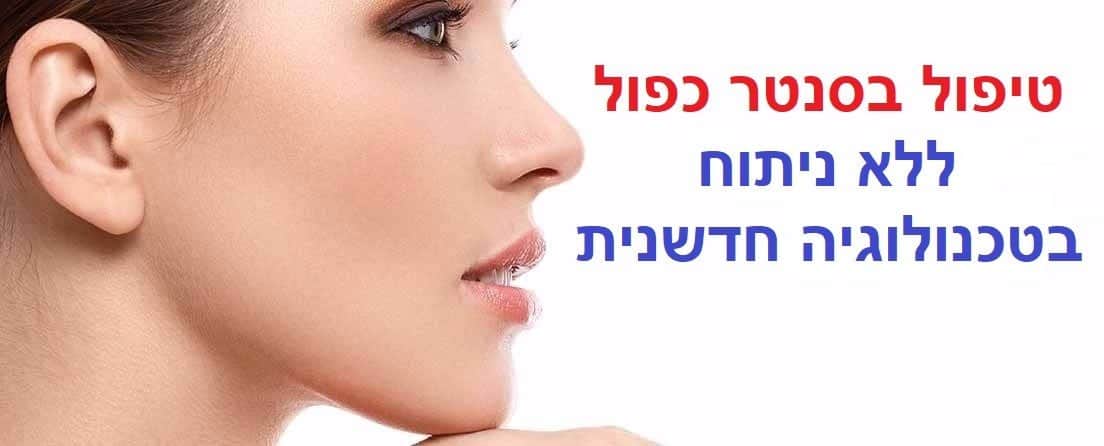 טיפול בסנטר כפול ללא ניתוח בנהריה | המסת שומן מסנטר כפול בנהריה