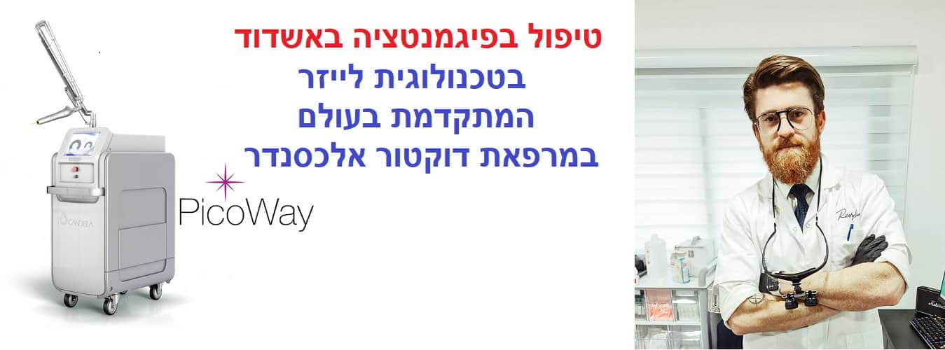 טיפול בפיגמנטציה בלייזר באשדוד