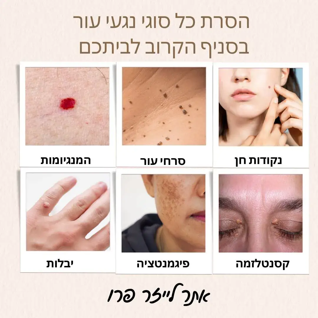 הסרת נגעי עור בפתח תקווה | טפול בנגעי עור בפתח תקווה
