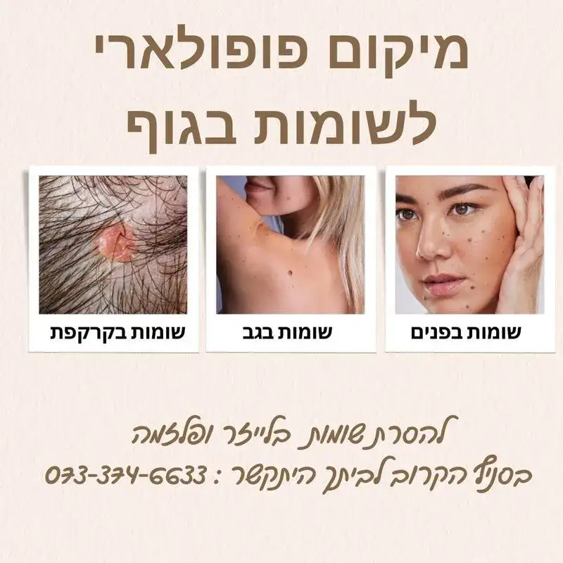 מיקום שומות בגוף