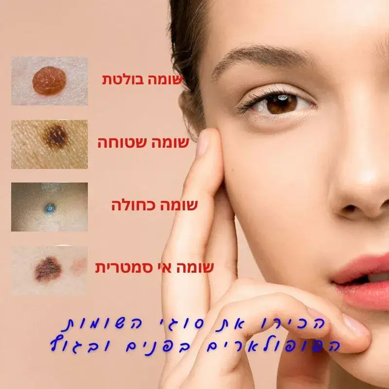 סוגי שומות בגוף ובפנים