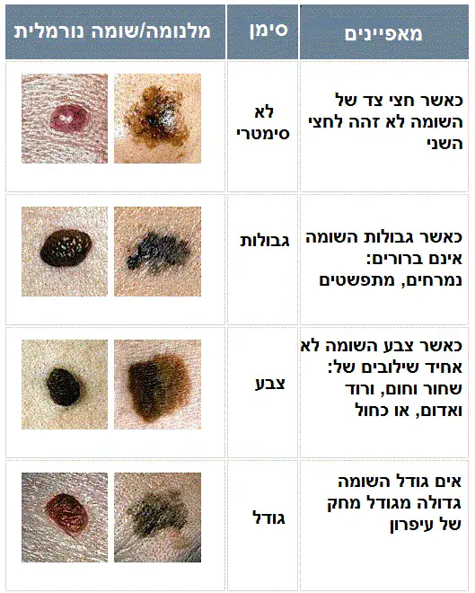 אבחון נקודות חן חשודה