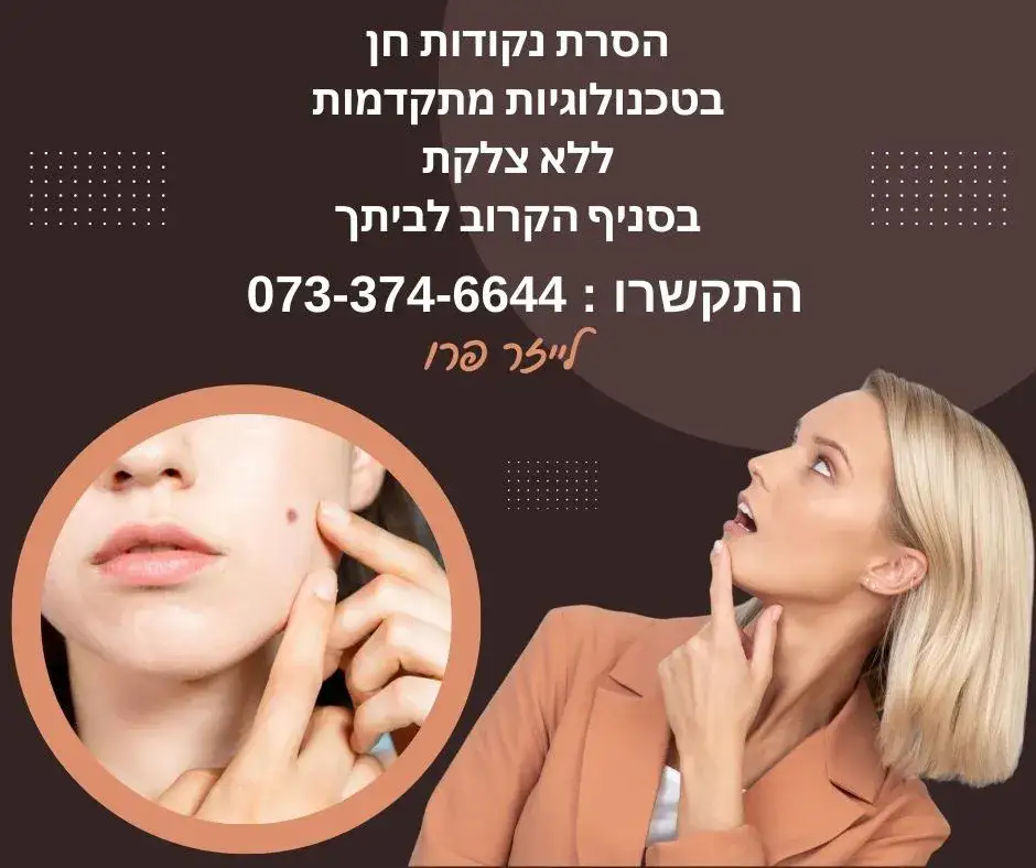 הסרת נקודות חן בעפולה