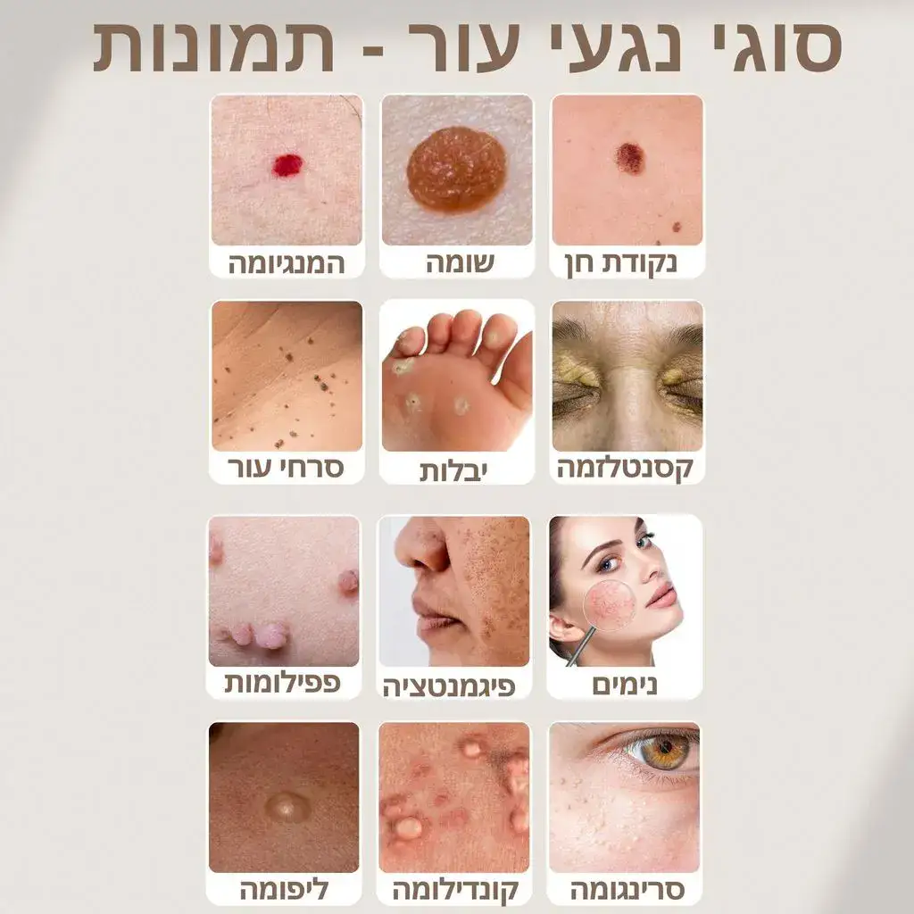 סוגי נגעי עור - תמונות