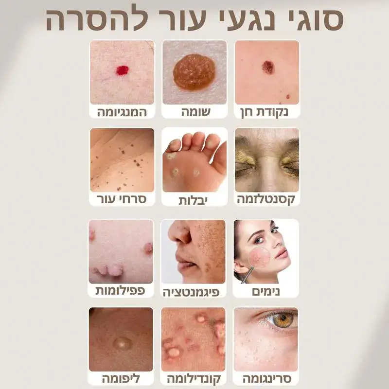 שתלים דנטליים בטורקיה / בחו"ל