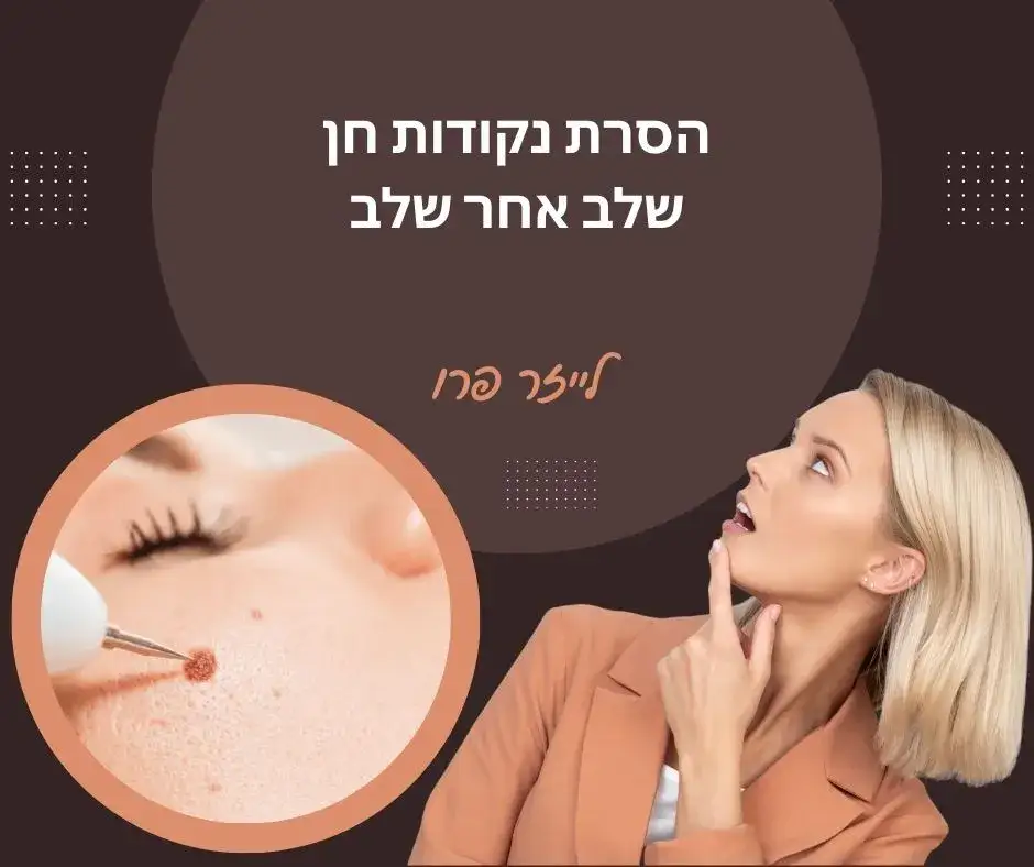 הסרת נקודות חן