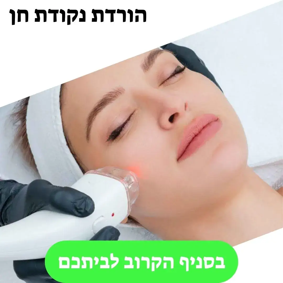 הורדת נקודות חן
