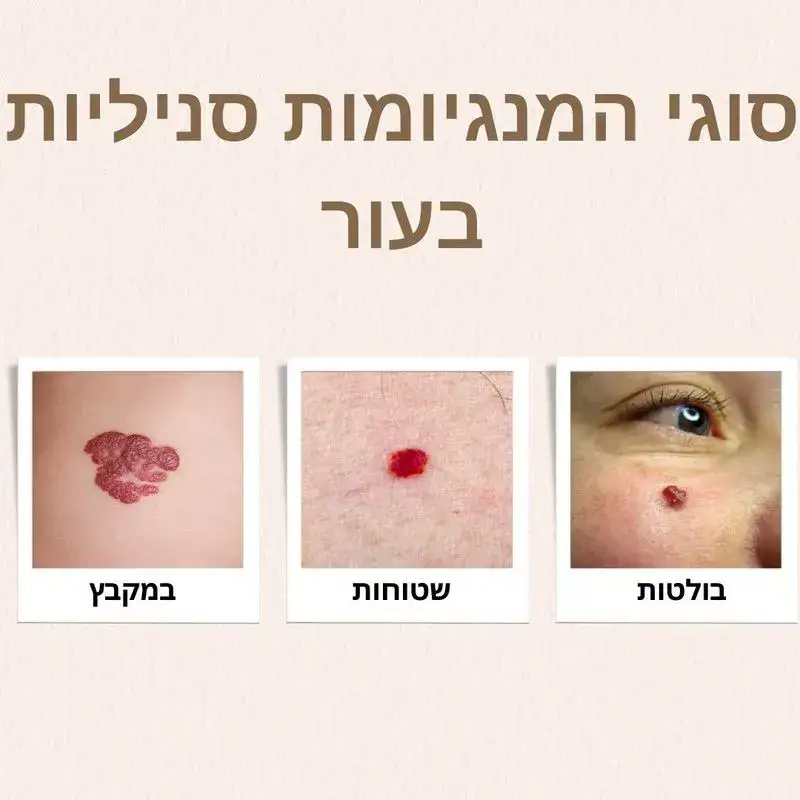 סוגי המנגיומות סניליות בעור