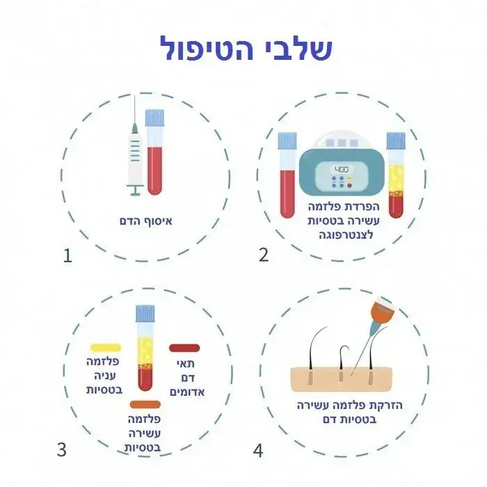 שלבי טיפול PRP לשיער