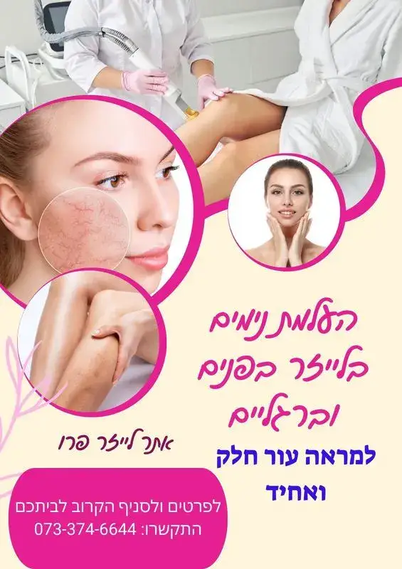 העלמת נימים באשדוד | הסרת נימים באשדוד