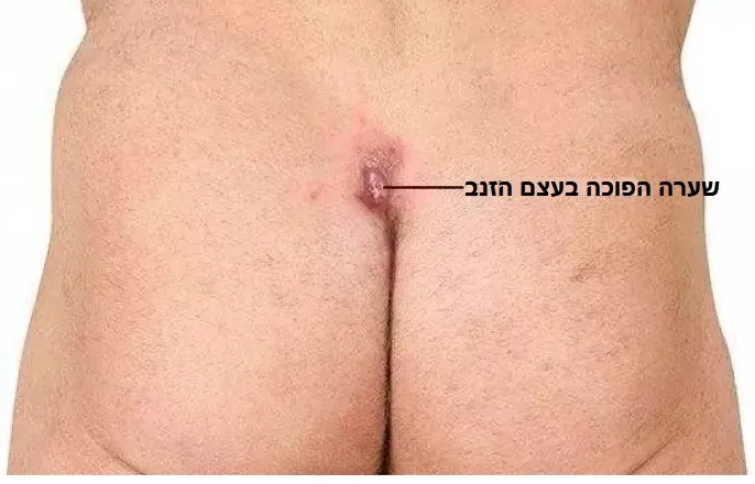 שערה הפוכה בעצם הזנב