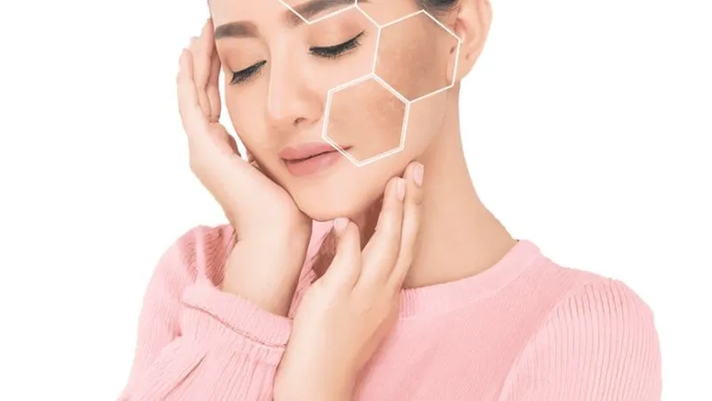 טיפול בפיגמנטציה בראשון לציון