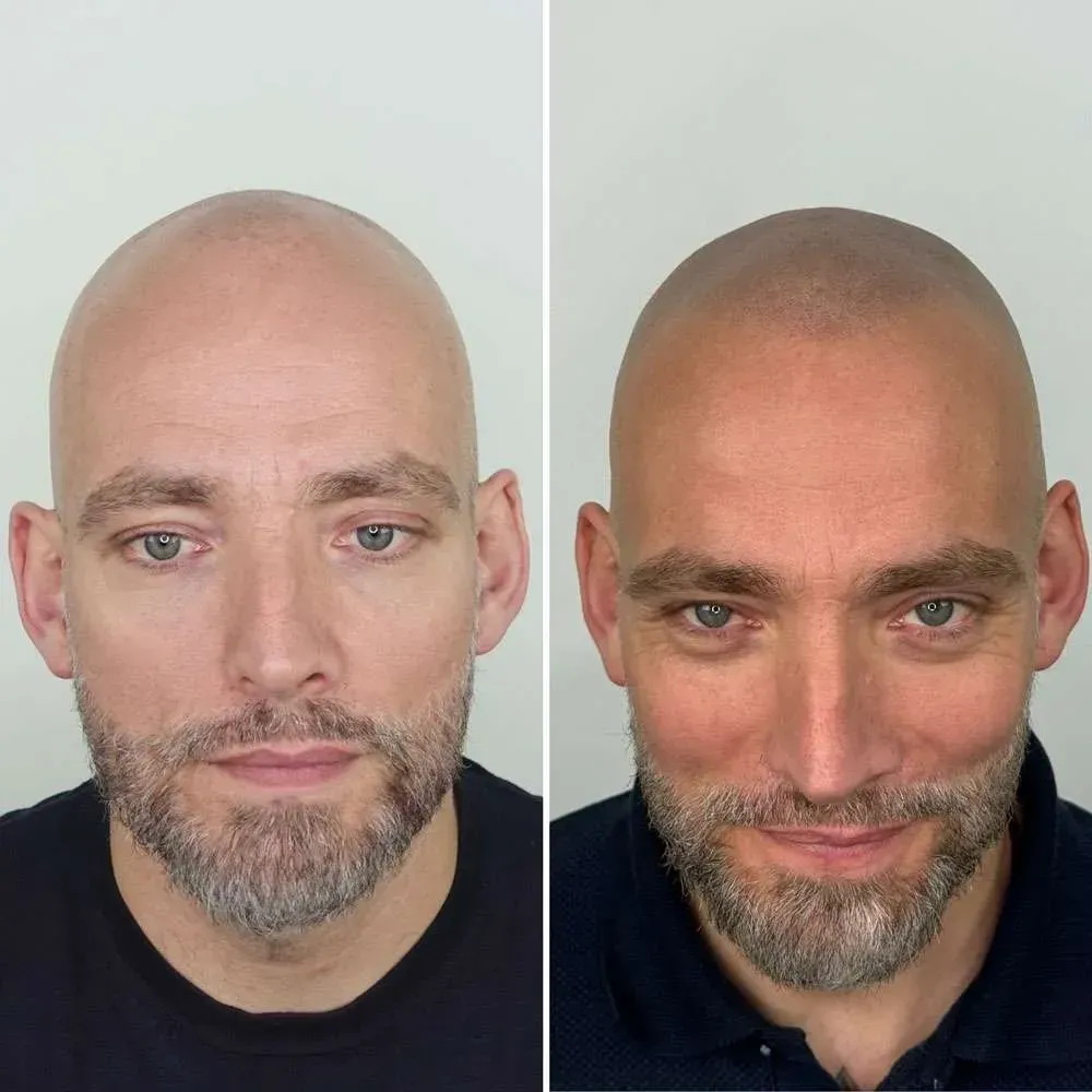 הדמיית שיער בגן יבנה