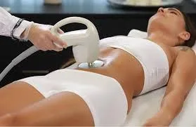 הצרת היקפים באשדוד