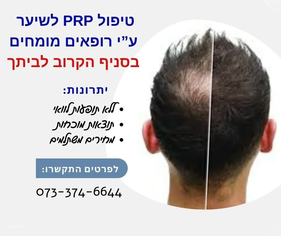 טיפול PRP לשיער באשדוד