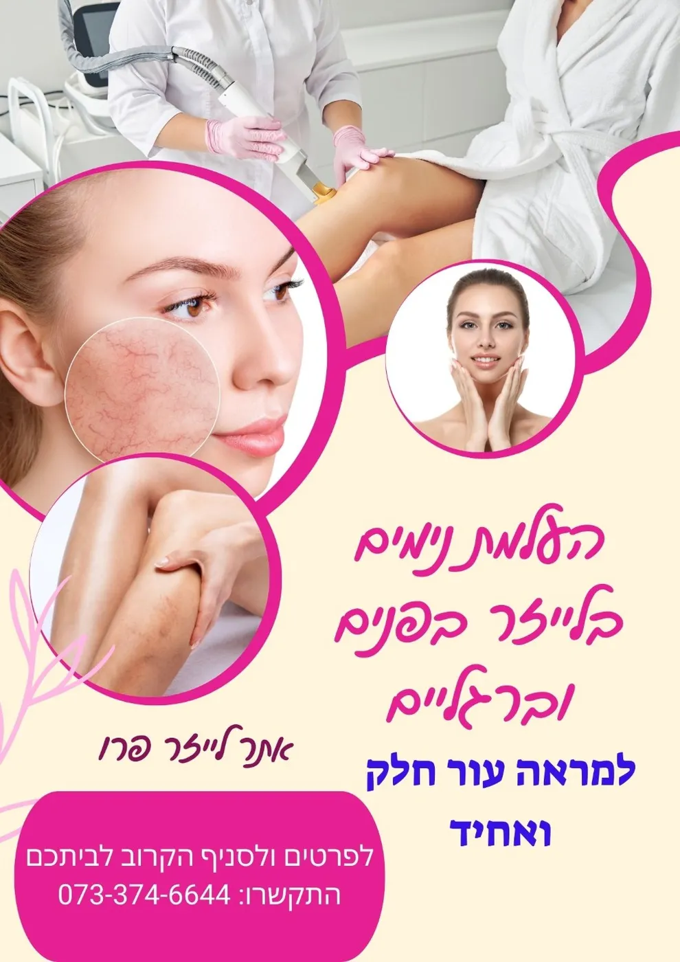 הסרת נימים באשדוד