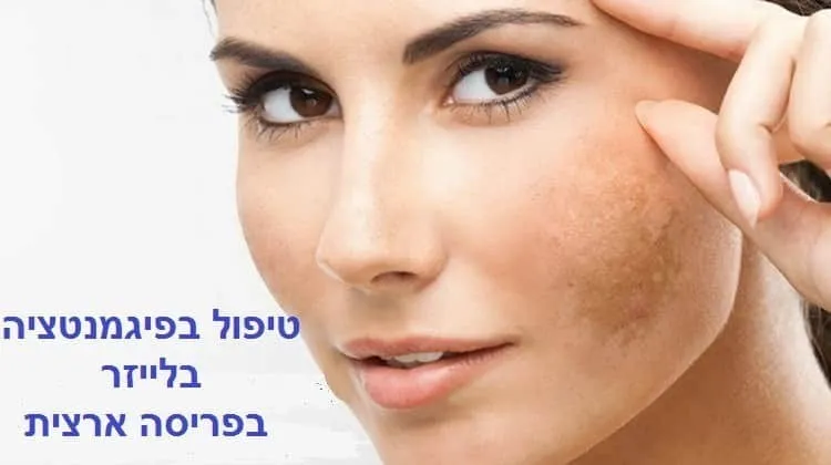 טיפול בפיגמנטציה בפנים בלייזר