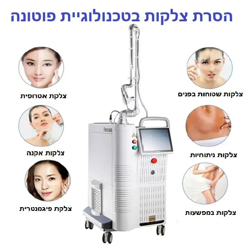 הסרת צלקות בטכנולוגיית פוטונה