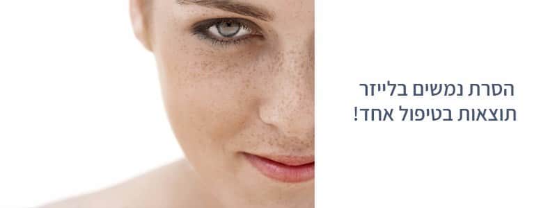 הסרת נמשים בלייזר בגן יבנה | טיפול בנמשים בגן יבנה